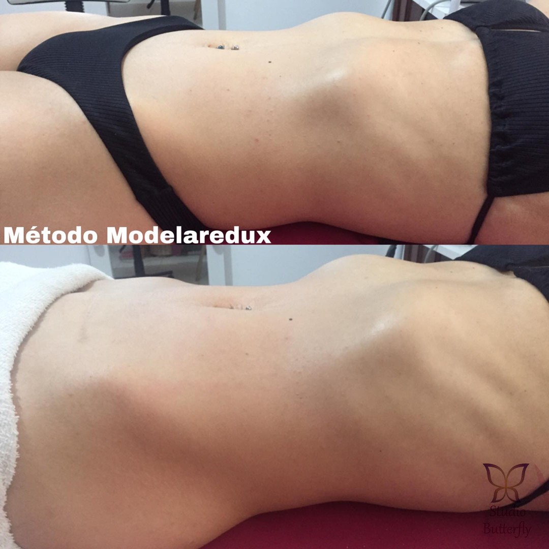 Evolução corporal registrada no Studio Butterfly