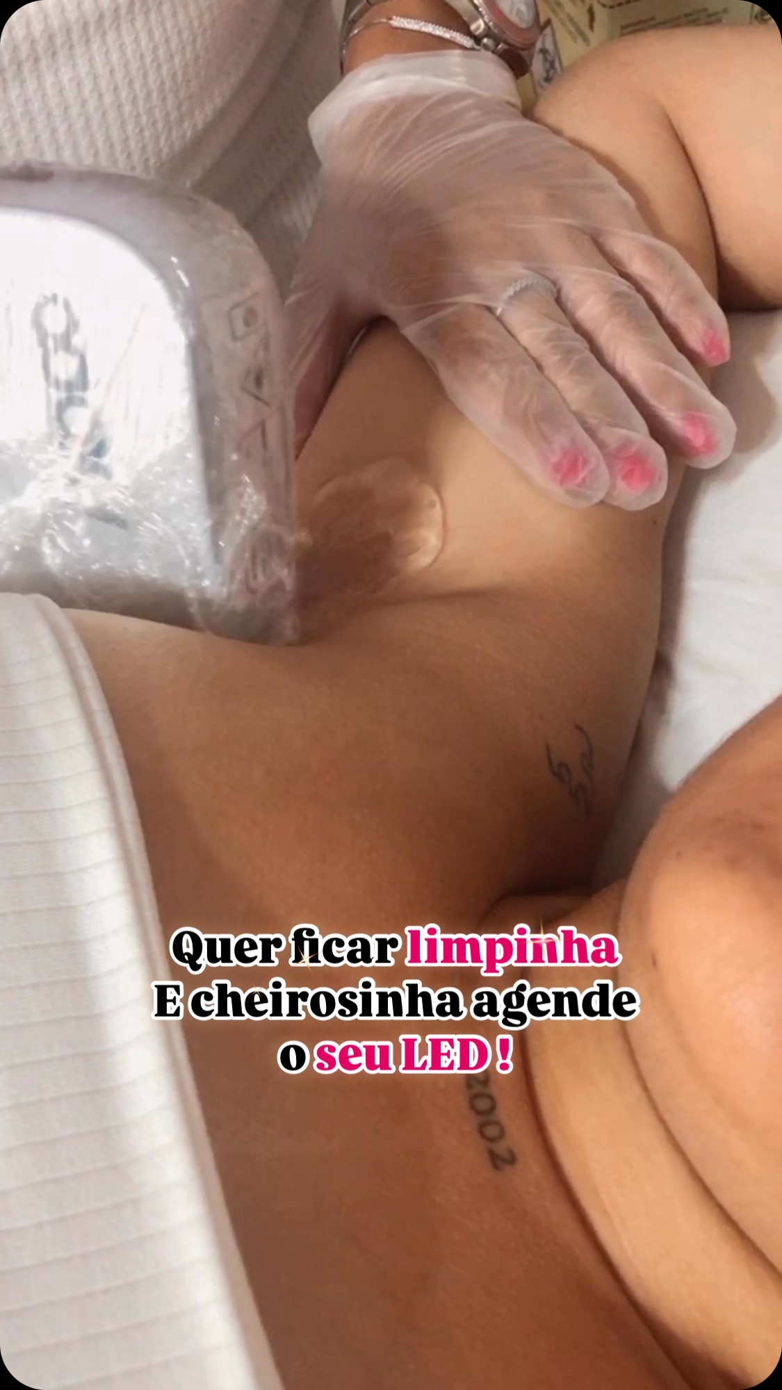 Procedimento Modelaredux no Studio Butterfly